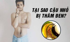 tại sao dương vật bị thâm đen